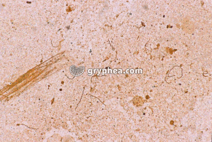 Tréponèmes2 x340 - gryphea.com